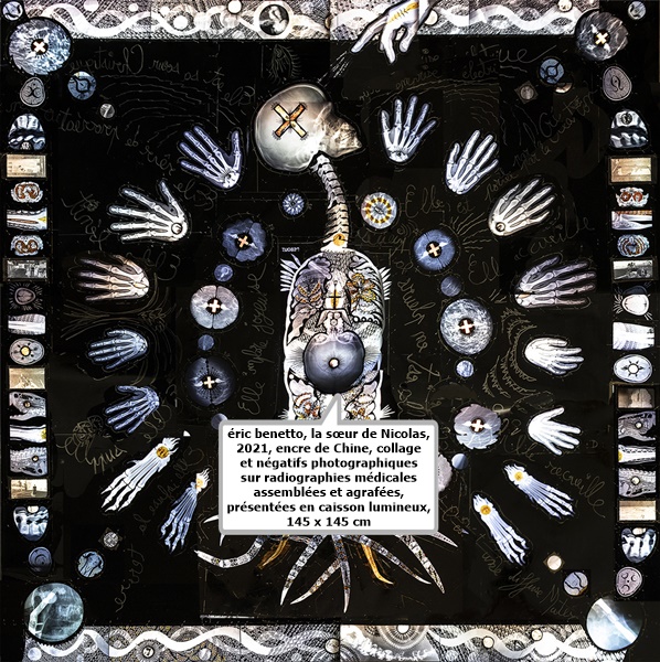 éric benetto, la sœur de Nicolas, 2021, encre de Chine, collage et négatifs photographiques sur radiographies médicales assemblées et agrafées, présentées en caisson lumineux, 145 x 145 cm